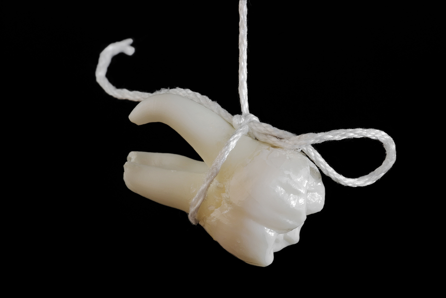 The Long-Term Effects of Tooth Extraction on Your Dental Health